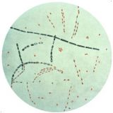 e coli endospore stain