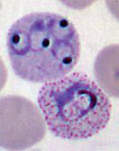 Plasmodium - Junglekey.fr Image