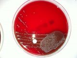 Enterococcus - JungleKey.fr Image #50