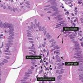 Duodenum - JungleKey.fr Image